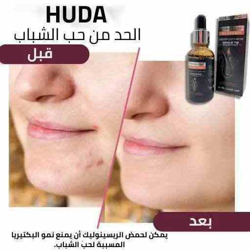 Huda's hair growth oil - HUDA