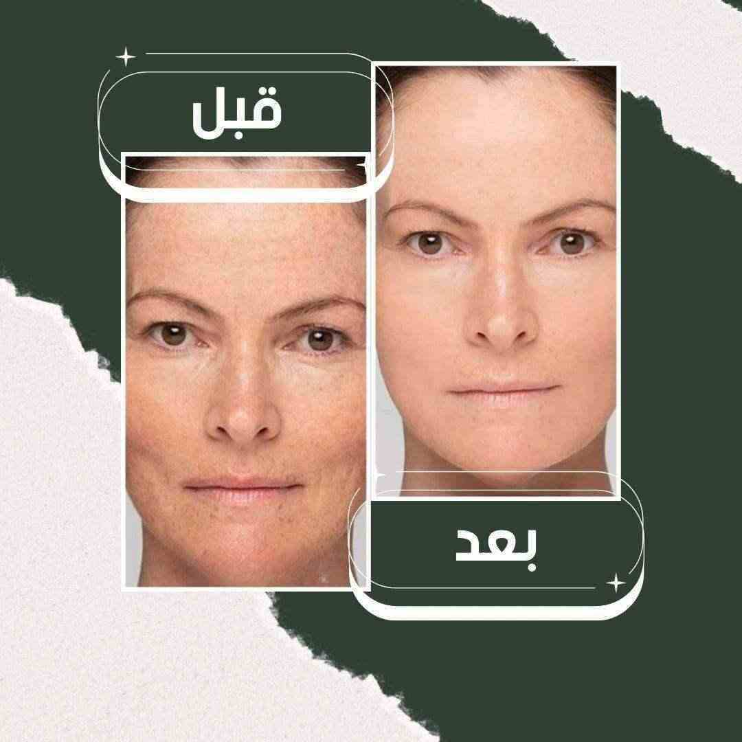 Collagen Face Mask - قناع الكولاجين للترطيب والتنظيف العميق - HUDA