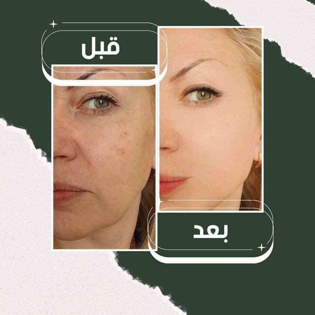 Collagen Face Mask - قناع الكولاجين للترطيب والتنظيف العميق - HUDA