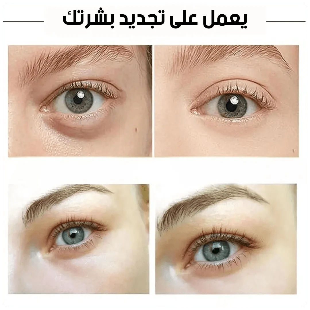 Eye Patches for Puffy Eyes – ماسك ذهبي للعين تحت العيون المتعبة