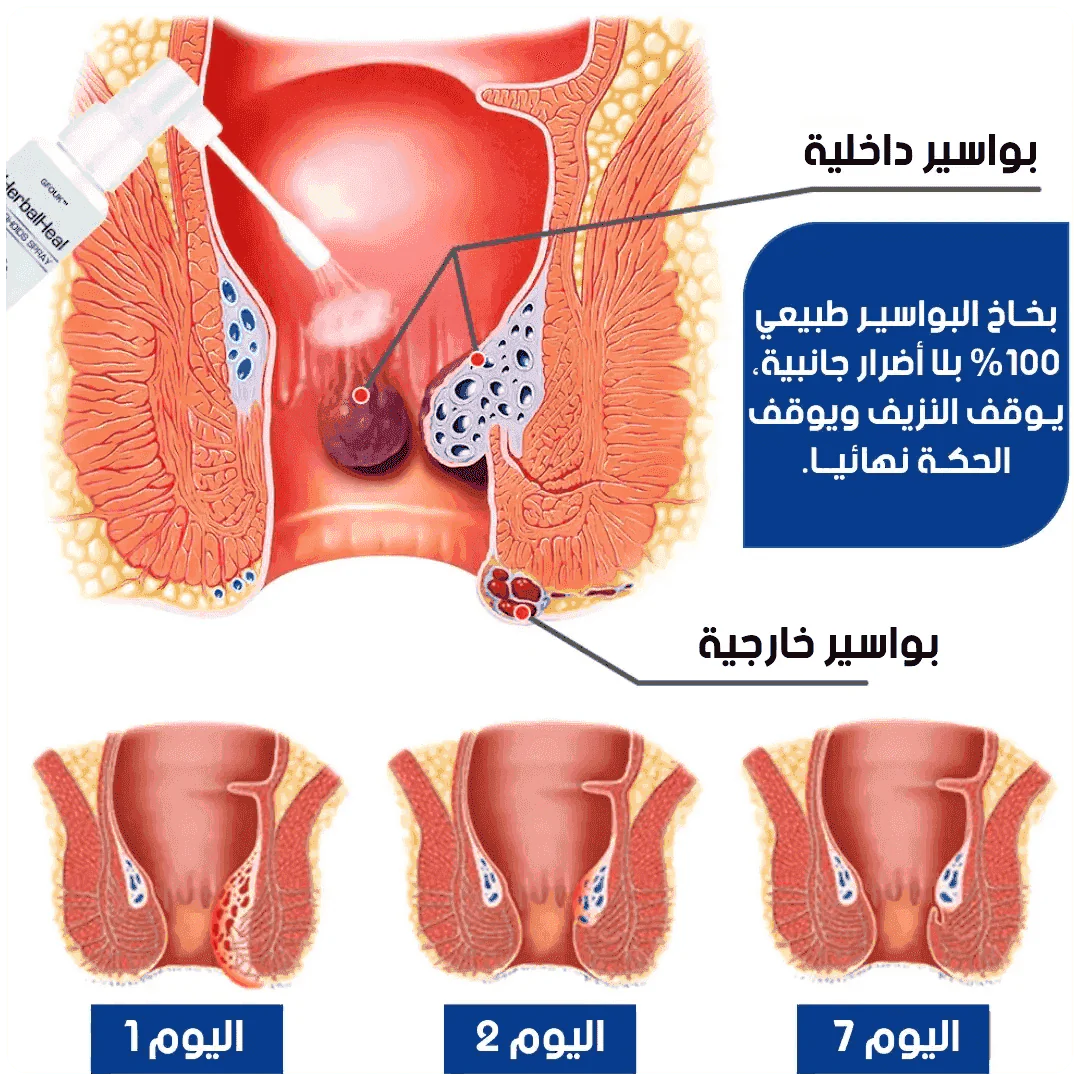 Sumifun Hemorrhoids Cream